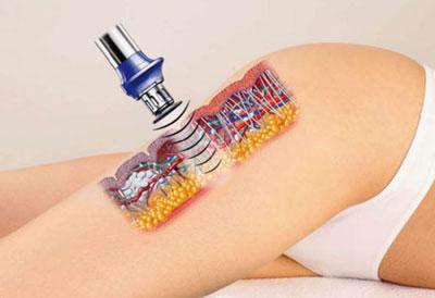 Бета-терапия