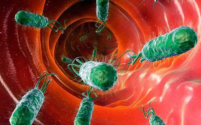 Дисбактериоз кишечника