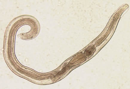 Enterobius-vermicularis.jpg
