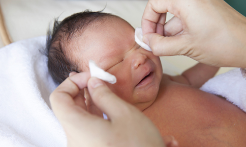 причина дакриоцистита