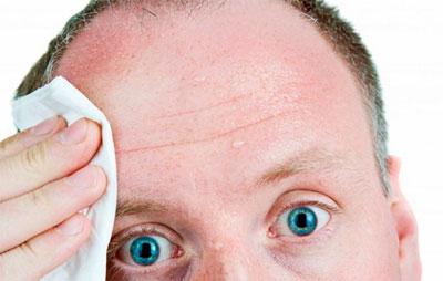 Холодная испарина