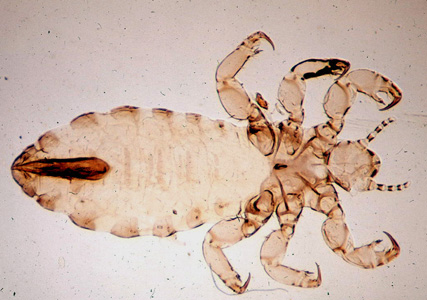 Pediculus-Humanus-Humanus3.jpg