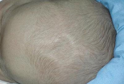 Родничок у ребенка