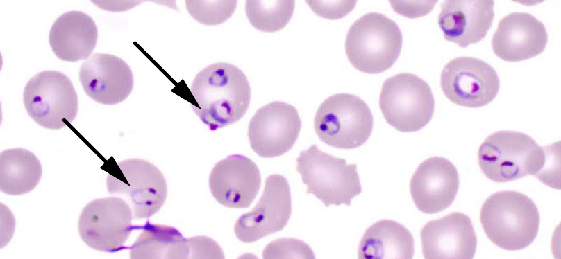 Plasmodium-falciparum2.jpg