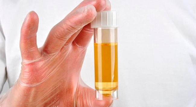 Помутнение мочи