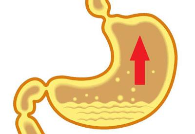 Повышенная кислотность