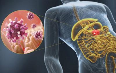 Проявление гастроэнтерита