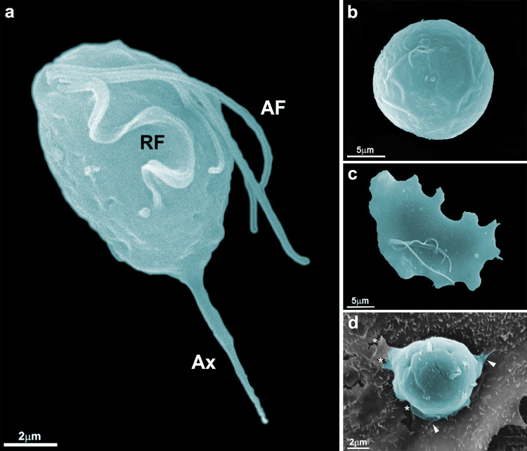 Trichomonas-tenax4.jpg