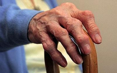 Уровская болезнь