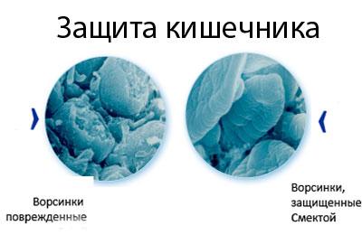 Действие смекты в кишечнике