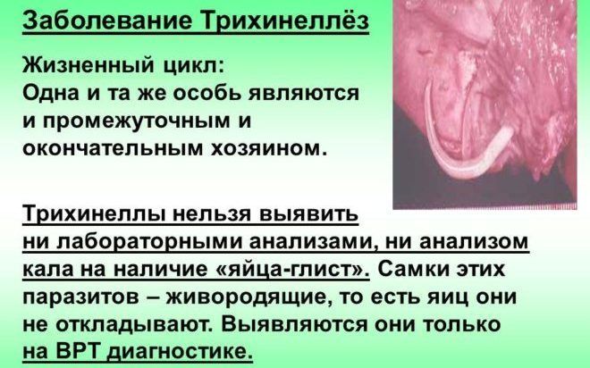 Zabolevanie-Trihinellyoz-e1500888427850-4.jpg