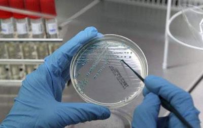 Посев на кишечную палочку