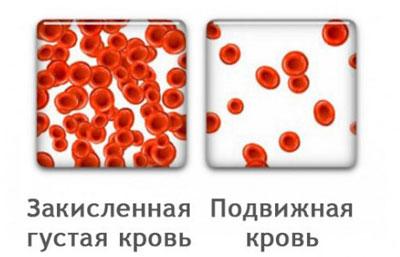 Кровь при ацидозе