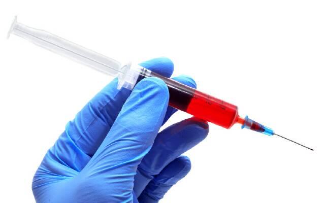 Анализ крови на содержание алкоголя