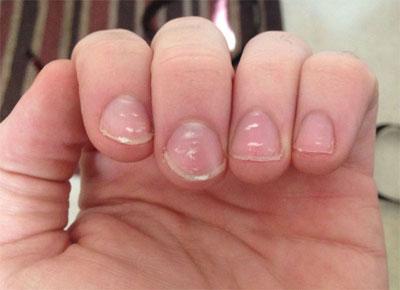 Белые точки на ногтях