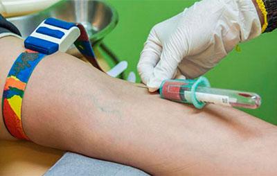 Кровь на биохимический анализ