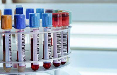 Биохимический анализ крови