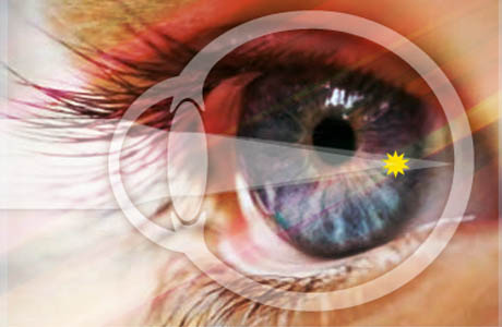 глаза при близорукости