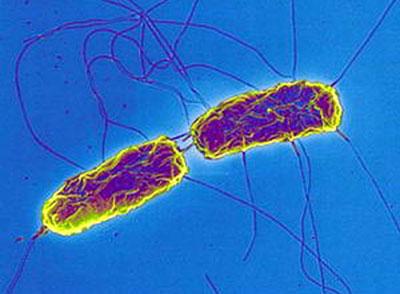 Возбудитель брюшного типа
