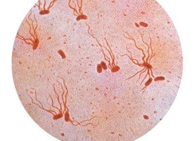 Брюшной тиф