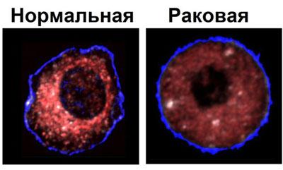 Нормальная и раковая клетки