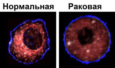 Нормальная и раковая клетки