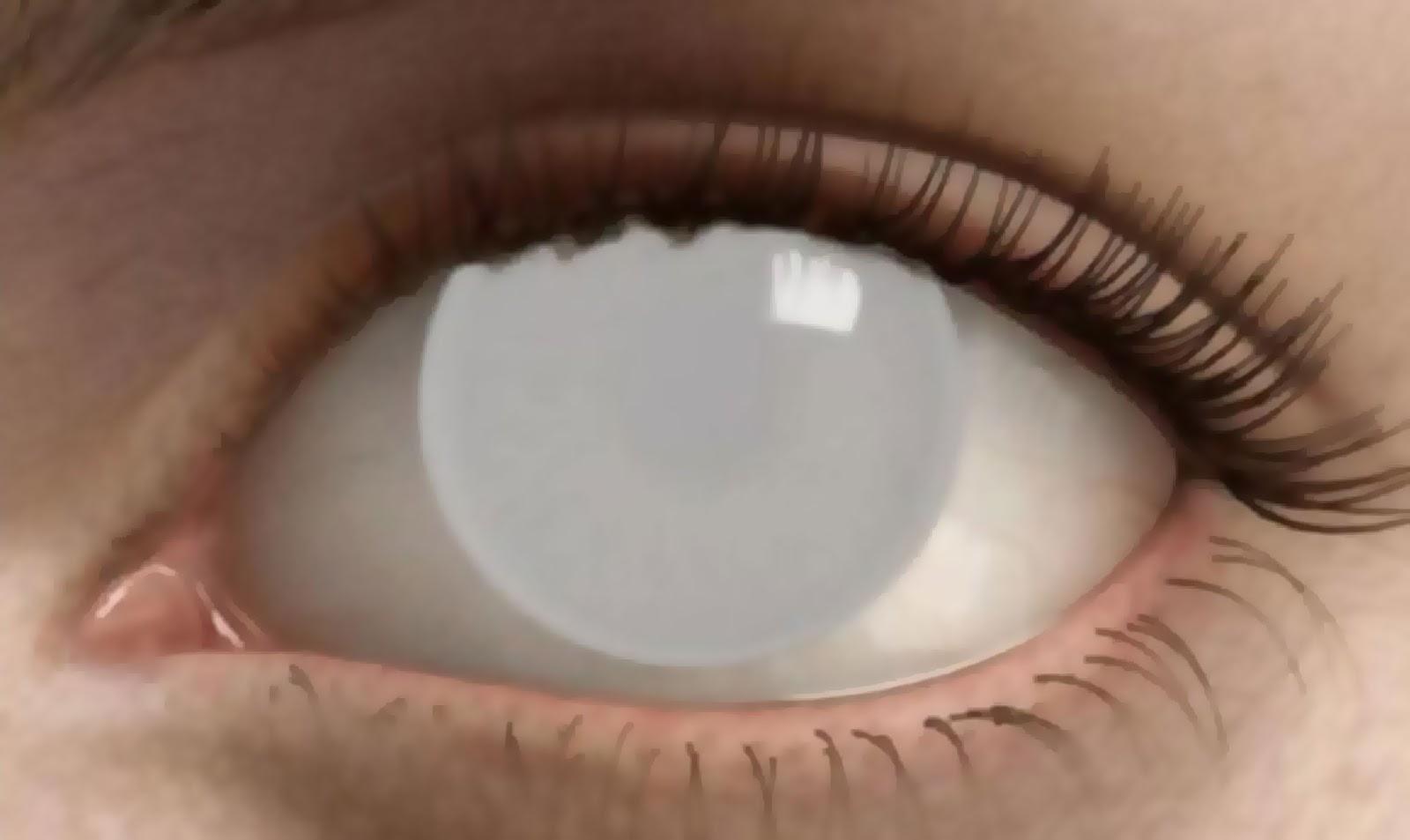 полная слепота