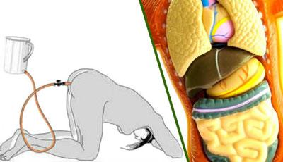 Проведение клизмы