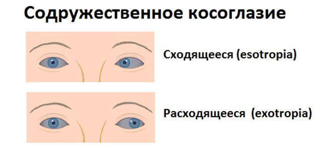 косоглазик виды