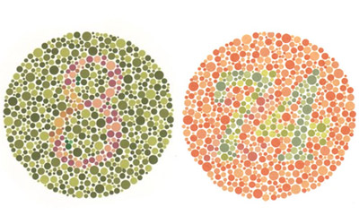 симптомы дальтонизма