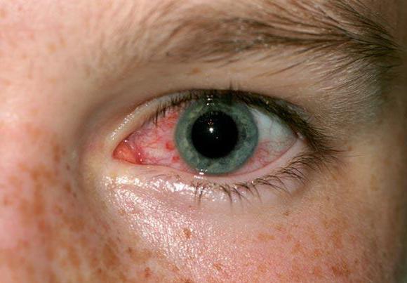 внешний вид демодекоза