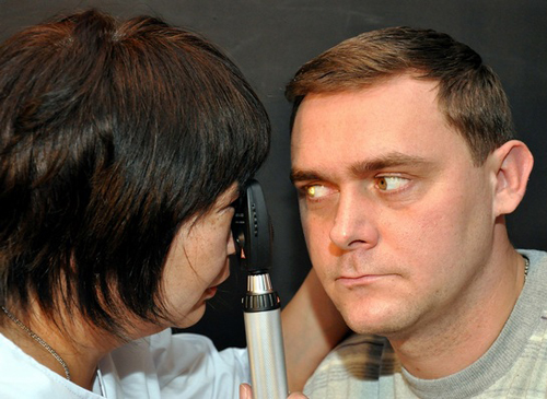 определение косоглазия