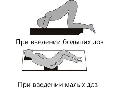 Положения тела при клизмировании