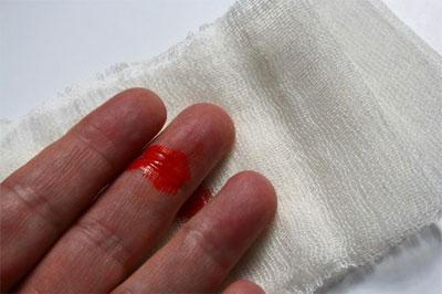 Плохая свертываемость крови