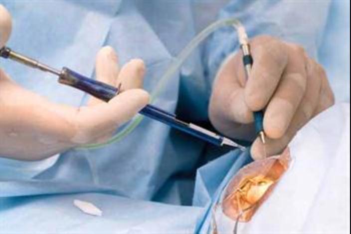 исправление зрения