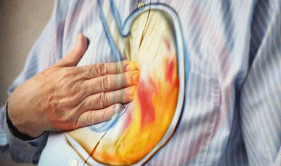 Частые изжоги