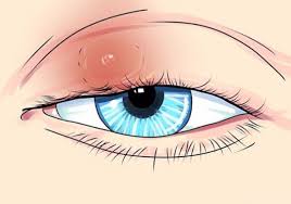 глаз больной