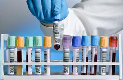 Анализ крови