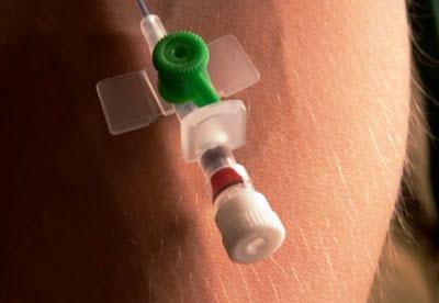 Внутривенный катетер