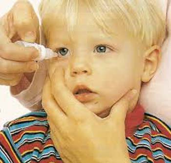 конъюнктивит-у-ребенка