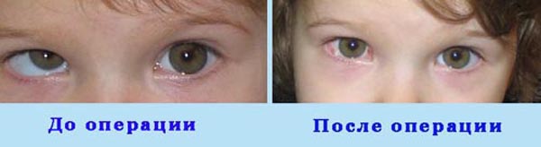 особенности