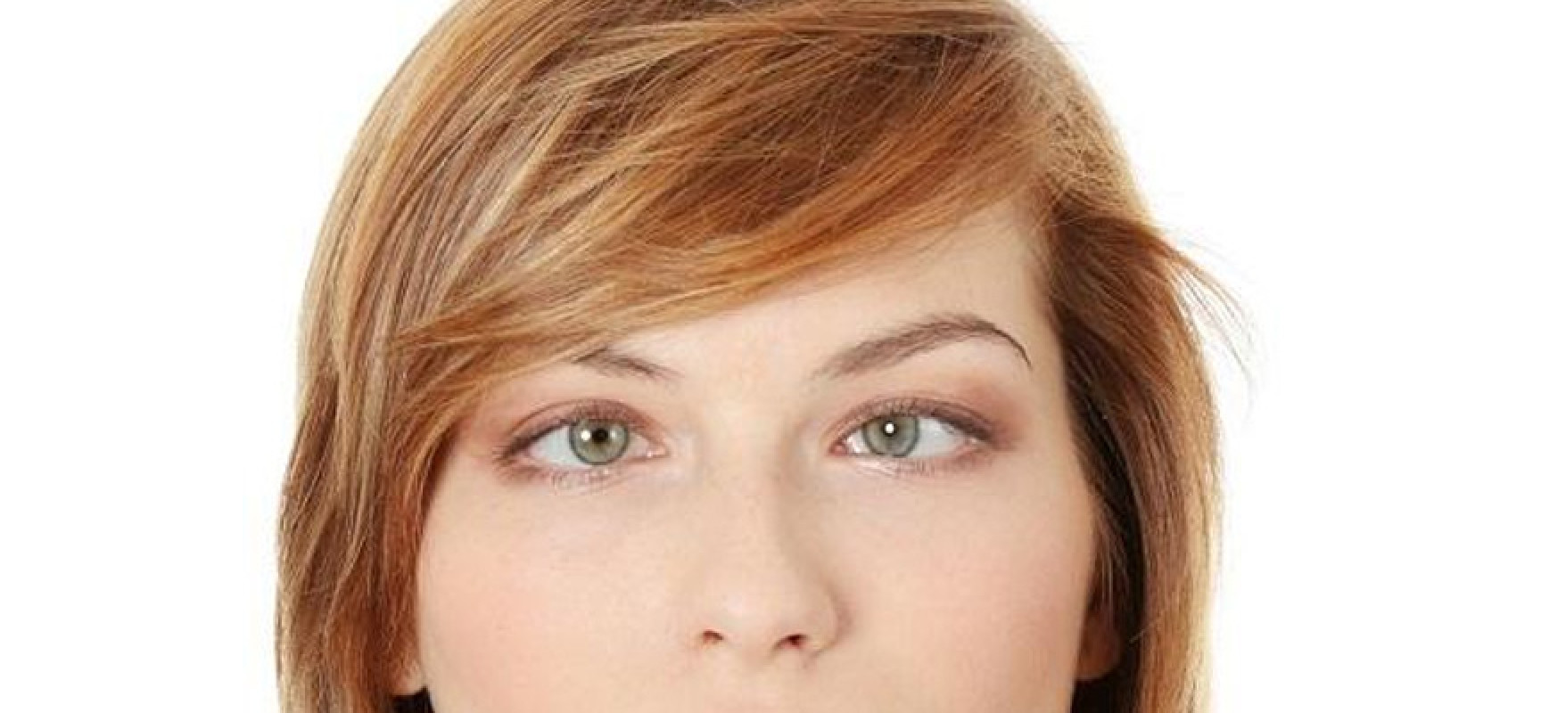 женское косоглазие