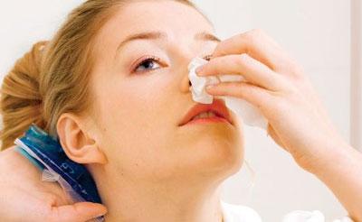 Кровотечение из носа