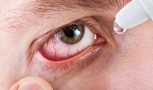 капли от чирья на глазах