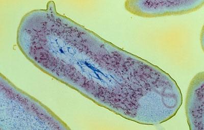 Шигелла под микроскопом