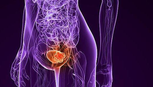 Мочевой пузырь