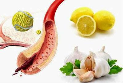 Лимон и чеснок для сосудов