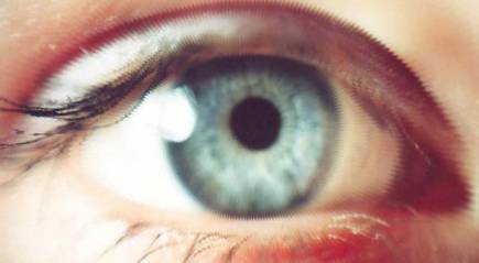 глаза при миопии