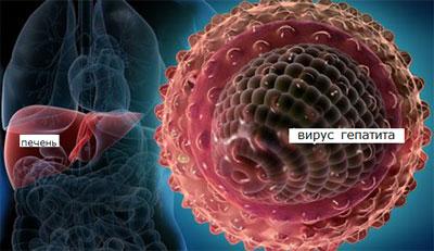 Вирусный гепатит
