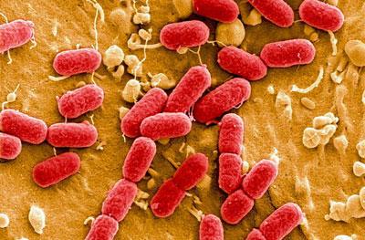 Кишечная палочка